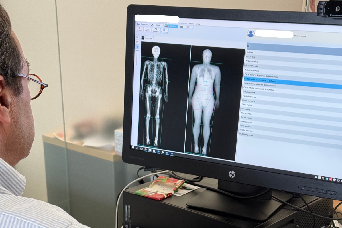 radiographie dexa scan